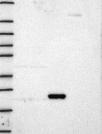 K-Ras Antibody in Western Blot (WB)