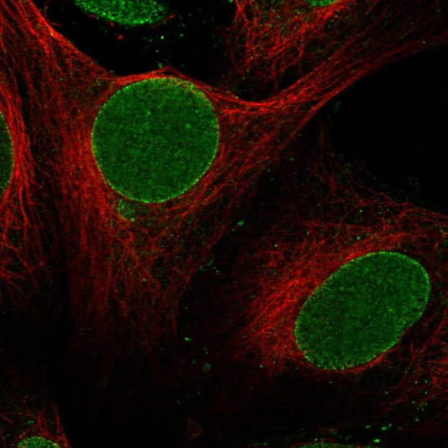 ZNF20 Antibody in Immunocytochemistry (ICC/IF)