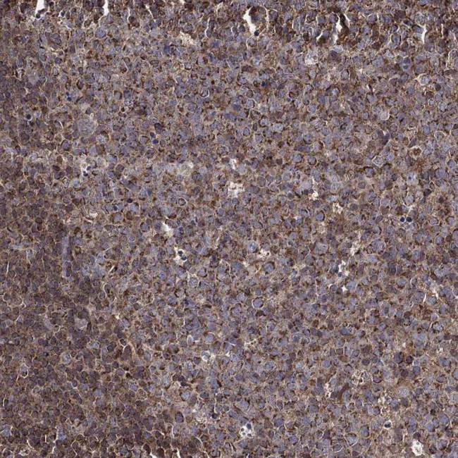 RIG-I Antibody in Immunohistochemistry (Paraffin) (IHC (P))