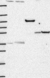 CRHR2 Antibody in Western Blot (WB)