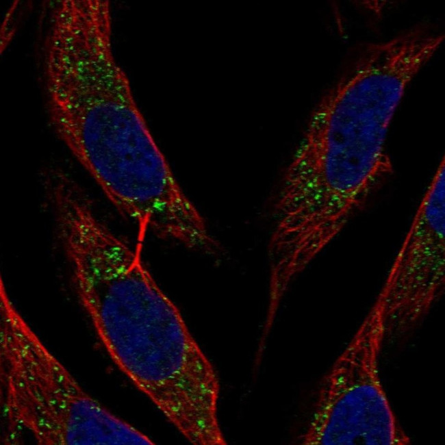 BST-2 Antibody in Immunocytochemistry (ICC/IF)