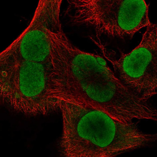 IFI16 Antibody in Immunocytochemistry (ICC/IF)