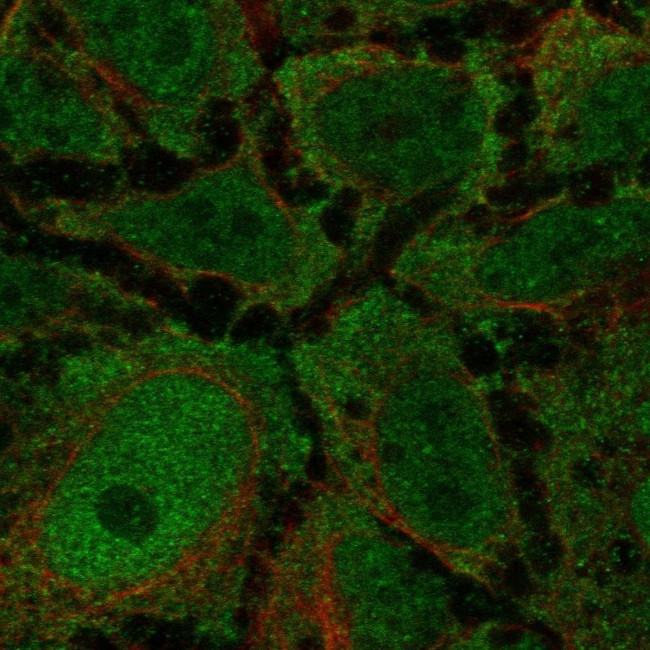 CCKAR Antibody in Immunocytochemistry (ICC/IF)