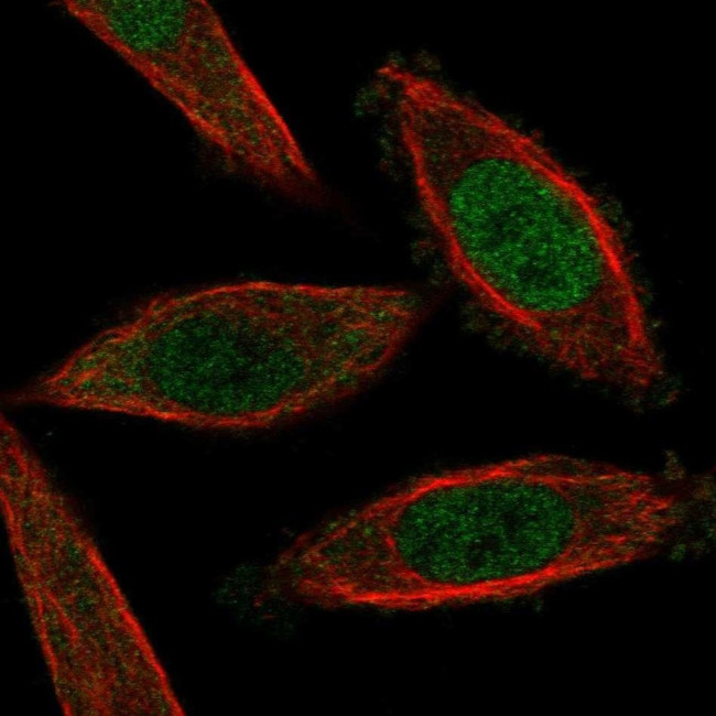 NFAT5 Antibody in Immunocytochemistry (ICC/IF)