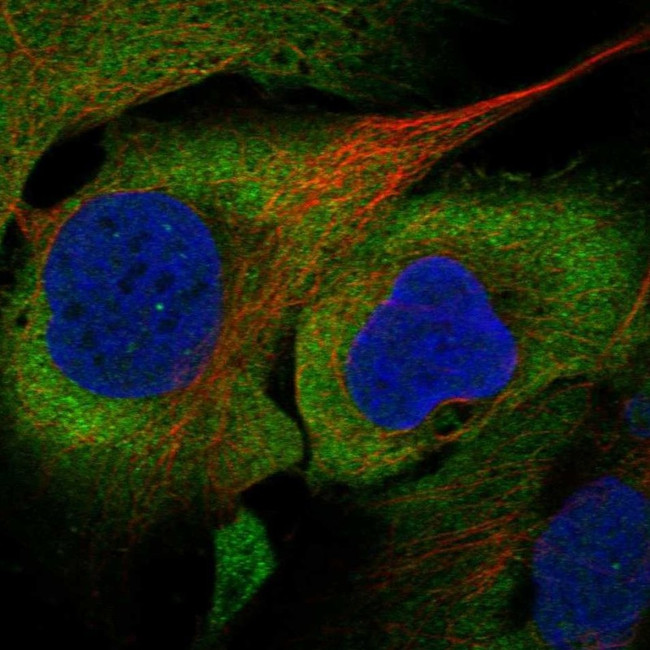 eIF5A Antibody in Immunocytochemistry (ICC/IF)