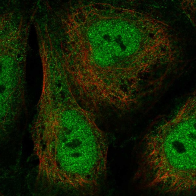 GTF2A1L Antibody in Immunocytochemistry (ICC/IF)