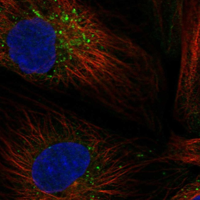 MATN3 Antibody in Immunocytochemistry (ICC/IF)