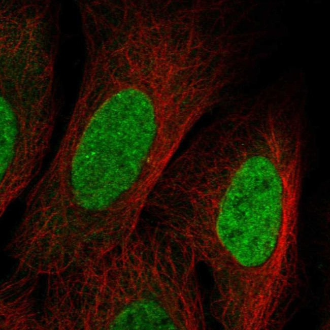 SUV420H2 Antibody in Immunocytochemistry (ICC/IF)