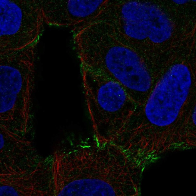 SPTLC2 Antibody in Immunocytochemistry (ICC/IF)