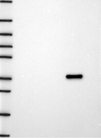 SPTLC2 Antibody in Western Blot (WB)