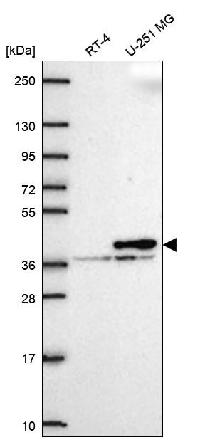 Calponin 2 Antibody in Western Blot (WB)