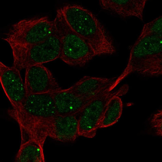 HAND1 Antibody in Immunocytochemistry (ICC/IF)