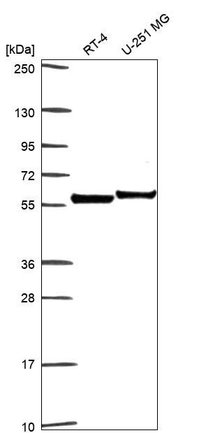 Apolipoprotein J Antibody in Western Blot (WB)