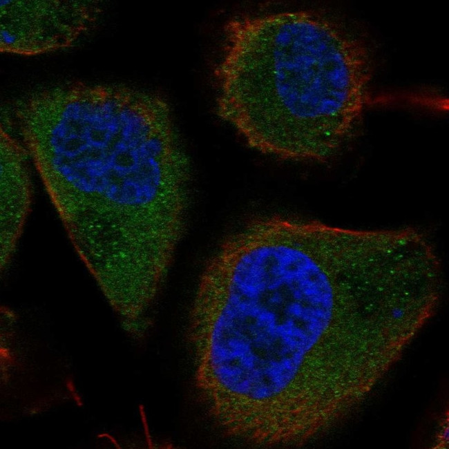 TBC1D13 Antibody in Immunocytochemistry (ICC/IF)