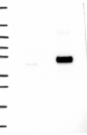 TBC1D13 Antibody in Western Blot (WB)