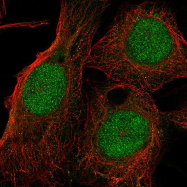 TXNL4A Antibody in Immunocytochemistry (ICC/IF)