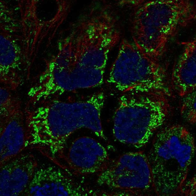 RAB5IF Antibody in Immunocytochemistry (ICC/IF)