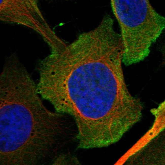 LEMD1 Antibody in Immunocytochemistry (ICC/IF)