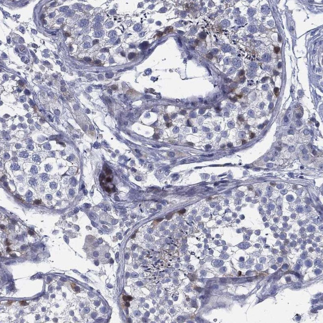 SPPL2C Antibody in Immunohistochemistry (Paraffin) (IHC (P))