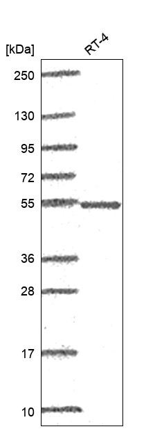 POLG2 Antibody in Western Blot (WB)