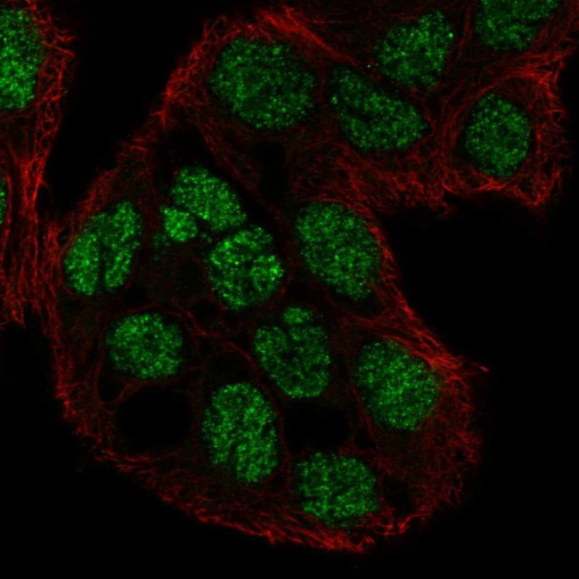 C2CD4A Antibody in Immunocytochemistry (ICC/IF)