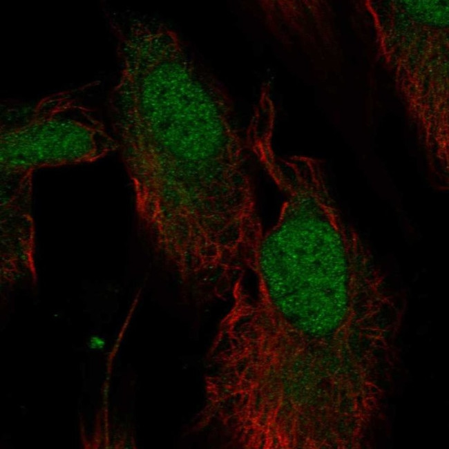 NT5D1 Antibody in Immunocytochemistry (ICC/IF)