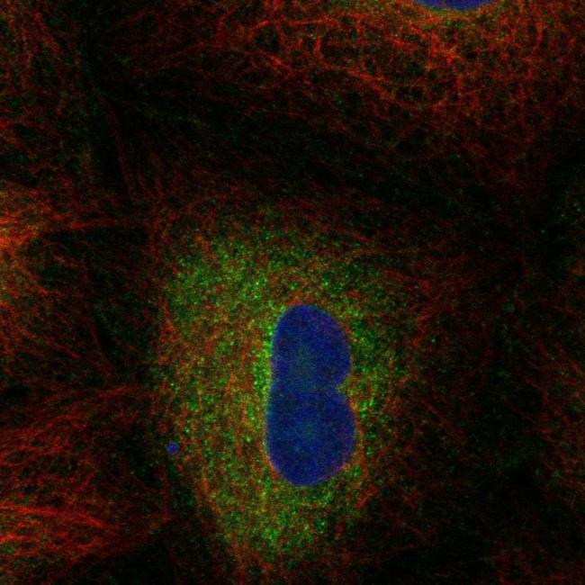 FADS2 Antibody in Immunocytochemistry (ICC/IF)