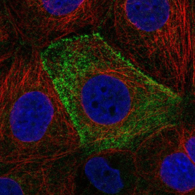 CSAD Antibody in Immunocytochemistry (ICC/IF)