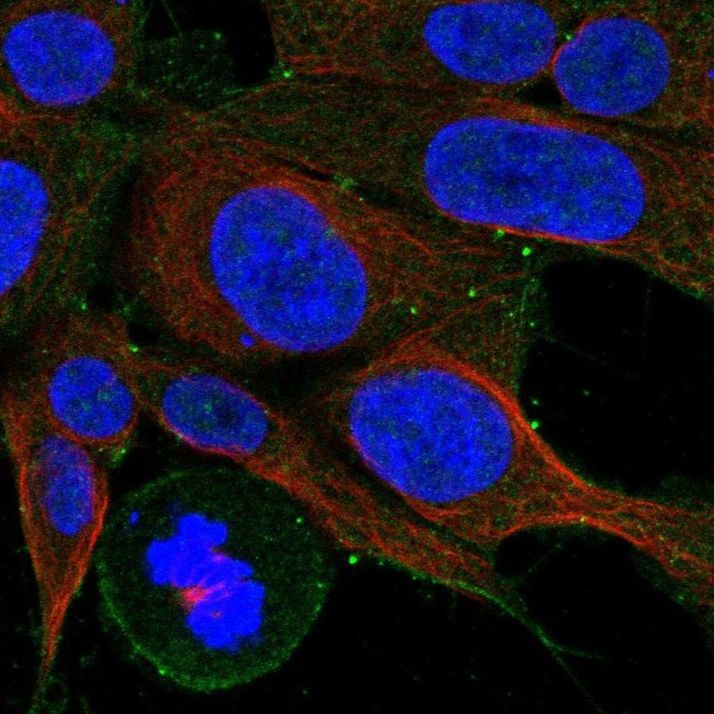 CCKBR Antibody in Immunocytochemistry (ICC/IF)