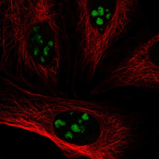 VSX1 Antibody in Immunocytochemistry (ICC/IF)