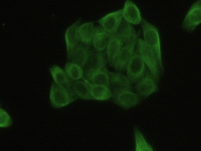 beta Tubulin Antibody in Immunocytochemistry (ICC/IF)