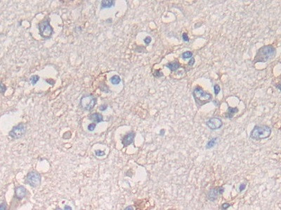 ATF6 Antibody in Immunohistochemistry (Paraffin) (IHC (P))