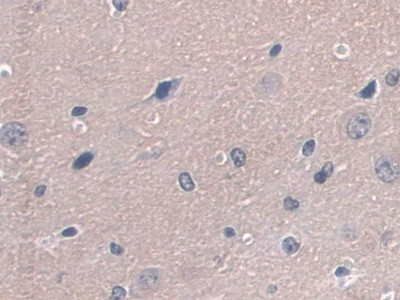 GPX3 Antibody in Immunohistochemistry (Paraffin) (IHC (P))