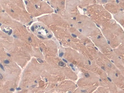 GPX3 Antibody in Immunohistochemistry (Paraffin) (IHC (P))