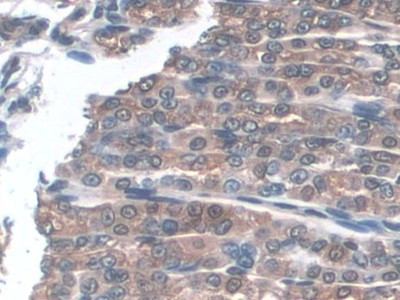 GPX3 Antibody in Immunohistochemistry (Paraffin) (IHC (P))