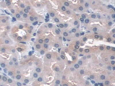 GPX3 Antibody in Immunohistochemistry (Paraffin) (IHC (P))