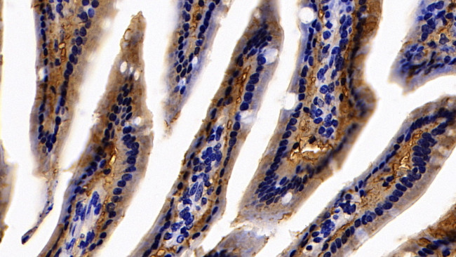 FABP1 Antibody in Immunohistochemistry (Paraffin) (IHC (P))