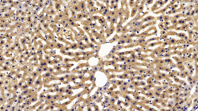 FABP1 Antibody in Immunohistochemistry (Paraffin) (IHC (P))