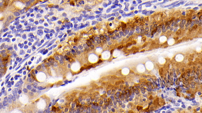 FABP1 Antibody in Immunohistochemistry (Paraffin) (IHC (P))