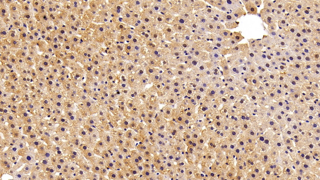 FABP1 Antibody in Immunohistochemistry (Paraffin) (IHC (P))