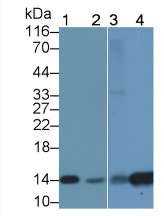 FABP1 Antibody in Western Blot (WB)