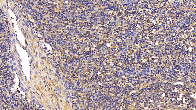 TGF beta-1 Antibody in Immunohistochemistry (Paraffin) (IHC (P))