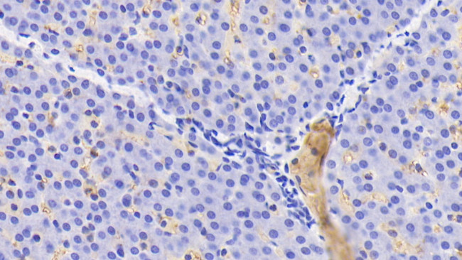 Hemoglobin Antibody in Immunohistochemistry (Paraffin) (IHC (P))