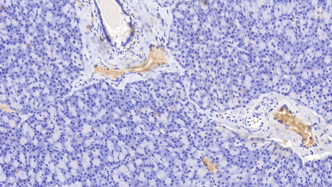 Hemoglobin Antibody in Immunohistochemistry (Paraffin) (IHC (P))