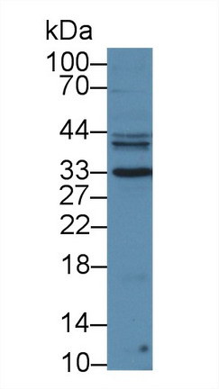 PSA Antibody in Western Blot (WB)