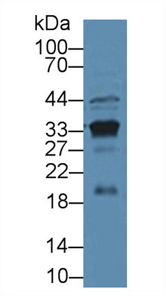 PSA Antibody in Western Blot (WB)