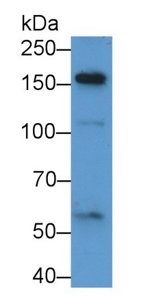 A2ML1 Antibody in Western Blot (WB)