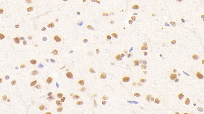 NUP88 Antibody in Immunohistochemistry (Paraffin) (IHC (P))