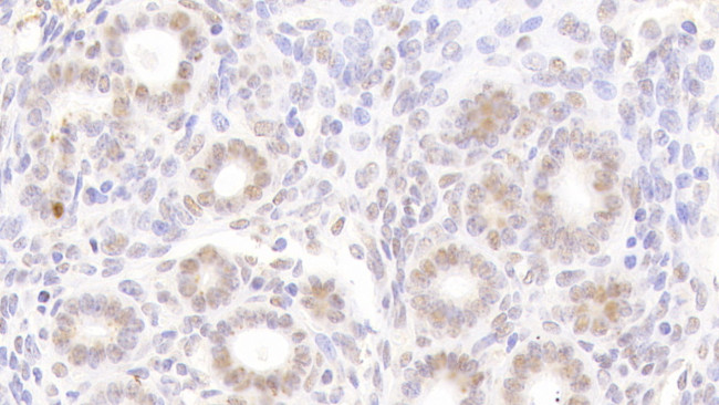 NUP88 Antibody in Immunohistochemistry (Paraffin) (IHC (P))