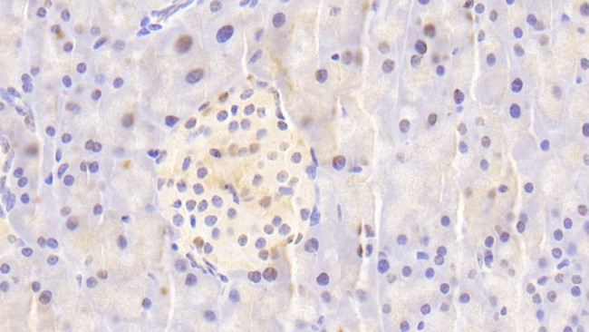 NUP88 Antibody in Immunohistochemistry (Paraffin) (IHC (P))